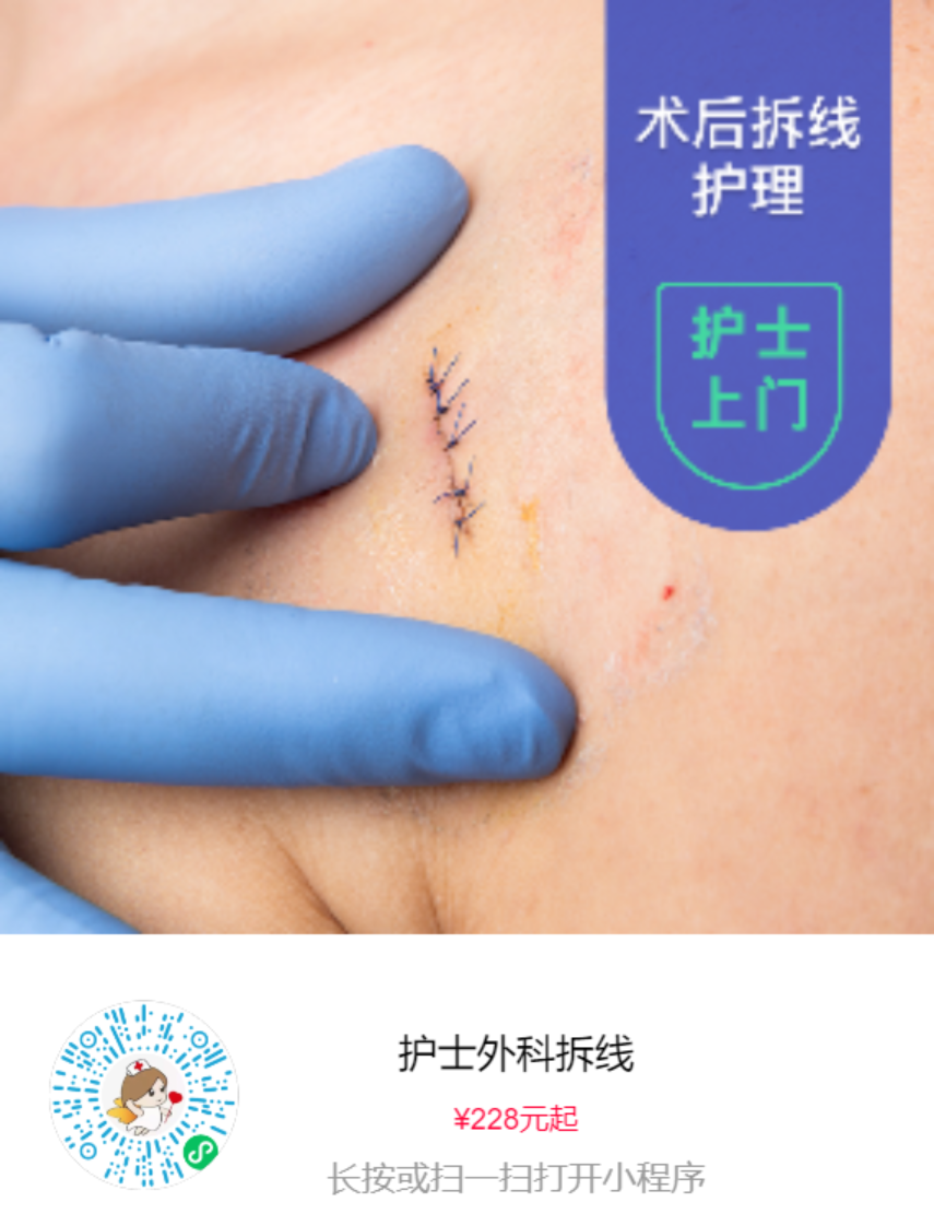 护士上门拆线